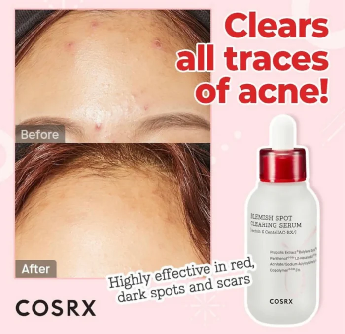⁦COSRX Blemish Spot Clearing Serum⁩ - الصورة ⁦4⁩