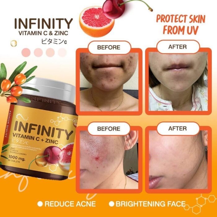 ⁦Gluta Infinity Vitamin C & Zinc 1000mg⁩ - الصورة ⁦5⁩