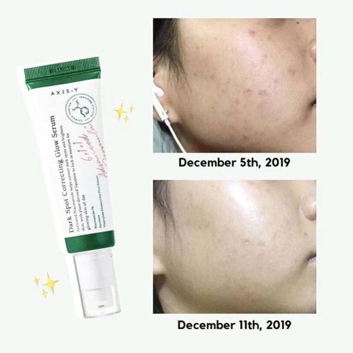 ⁦Dark Spot Correcting Glow Serum⁩ - الصورة ⁦4⁩