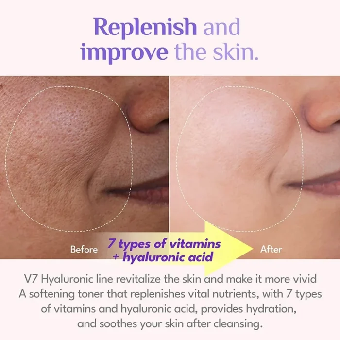 ⁦IT'S SKIN V7 Hyaluronic Toner⁩ - الصورة ⁦4⁩