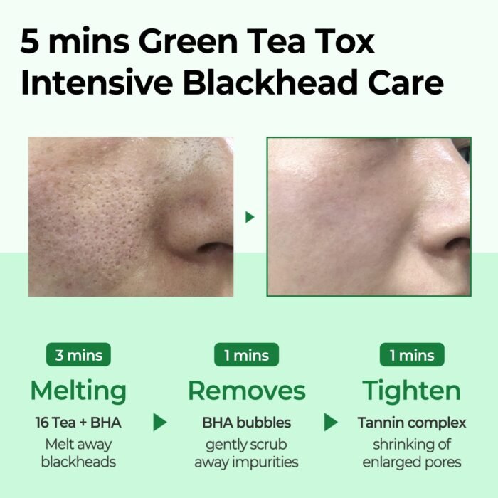 ⁦Miracle Green Tea Tox Bubble Cleanser⁩ - الصورة ⁦4⁩