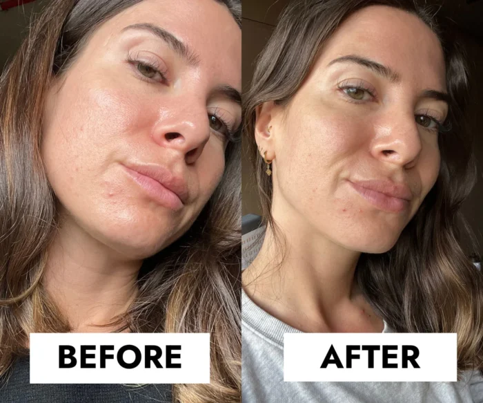 ⁦blemish control cleanser⁩ - الصورة ⁦2⁩