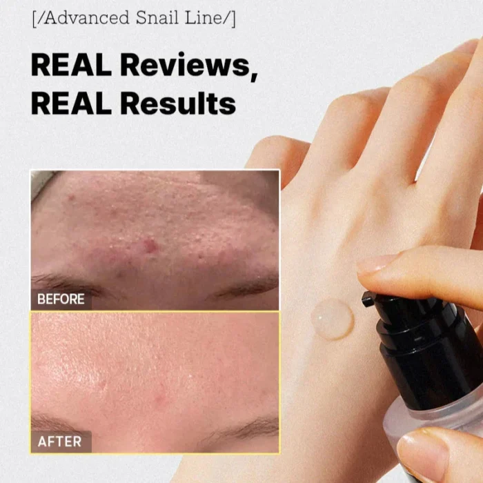 ⁦COSRX Advanced Snail 96Mucin Power essence⁩ - الصورة ⁦4⁩