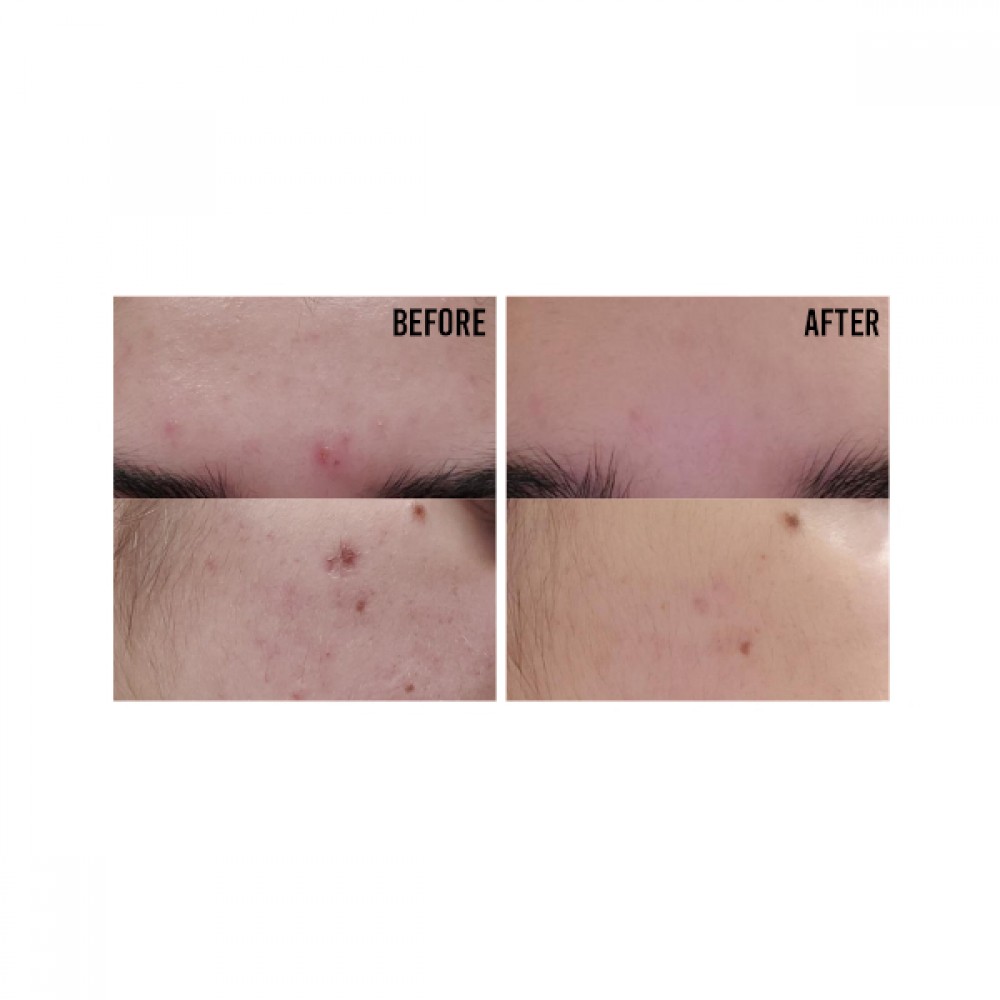 Cos De BAHA - AZ Azelaic Acid 10 Serum 30ml - الصورة 3