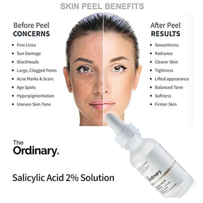 ⁦Salicylic Acid 2% Solution⁩ - الصورة ⁦3⁩