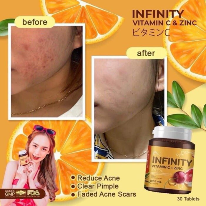 ⁦Gluta Infinity Vitamin C & Zinc 1000mg⁩ - الصورة ⁦4⁩