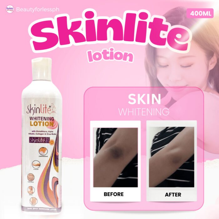 ⁦Skinlite Whitening Lotion 400ml ‏⁩ - الصورة ⁦2⁩