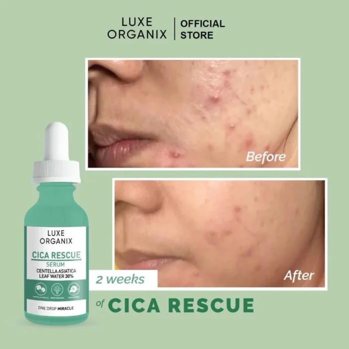 ⁦Cica Rescue Gentle Brightening Serum 30ml⁩ - الصورة ⁦2⁩