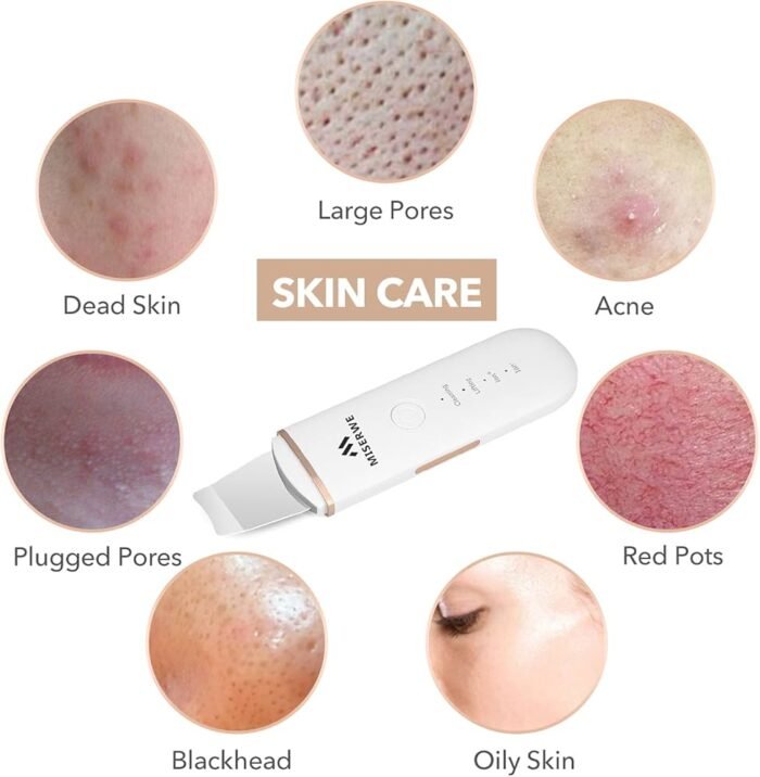 ⁦Ultrasonic face Skin Scrubber⁩ - الصورة ⁦3⁩