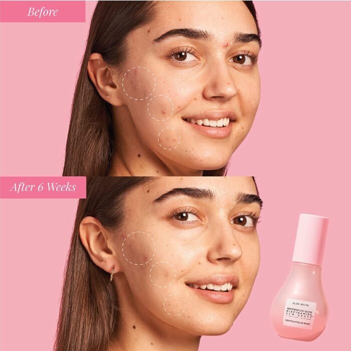 ⁦Watermelon Glow Niacinamide Dew Drops⁩ - الصورة ⁦3⁩