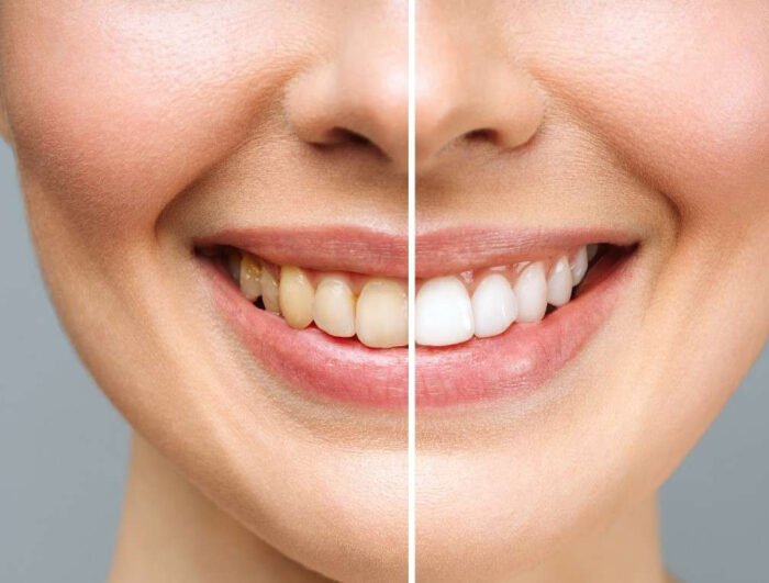⁦Natural Activated Charcoal Teeth Whitening Powder , mint⁩ - الصورة ⁦4⁩