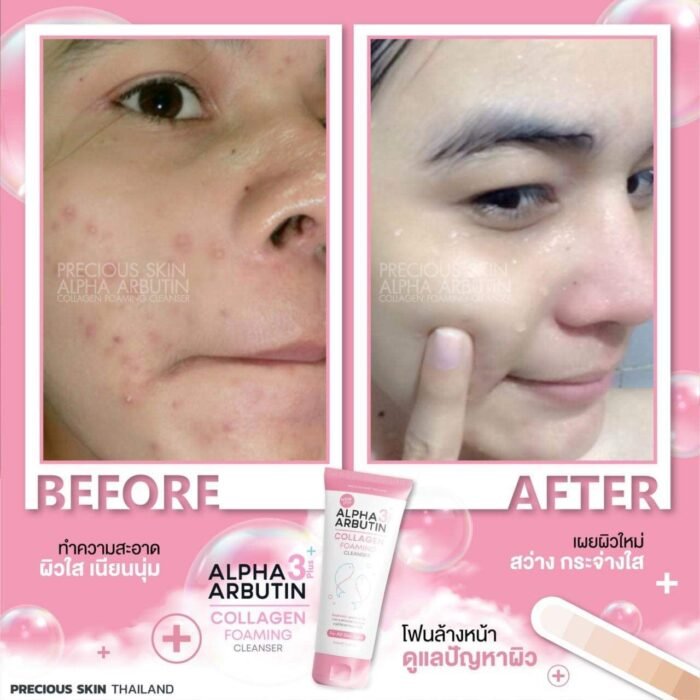 ⁦ALPHA ARBUTIN COLAGEN FOAMING CLEANSER 120g⁩ - الصورة ⁦4⁩