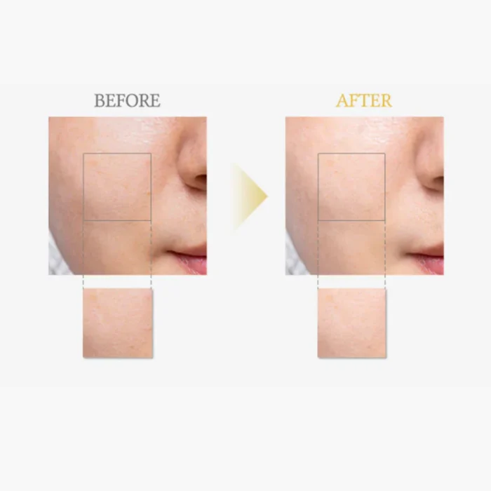 ⁦Dr. Althea 63% Vitamin C Boosting Serum (renewal) 30ml.⁩ - الصورة ⁦3⁩