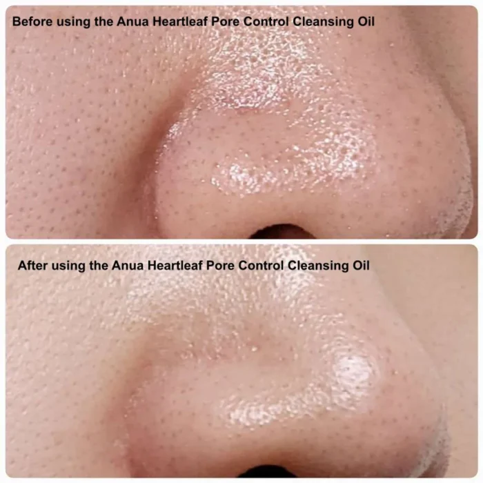 ⁦Anua Heartleaf Pore Control Cleansing Oil Mild 200 ml⁩ - الصورة ⁦8⁩
