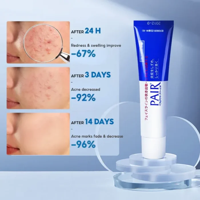 ⁦LION PAIR Acne Cream 2 SIZE⁩ - الصورة ⁦4⁩