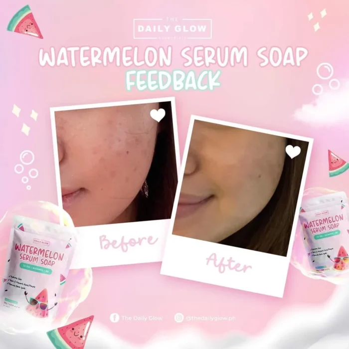 ⁦The Daily Glow WATERMELON SERUM SOAP | 135G⁩ - الصورة ⁦6⁩