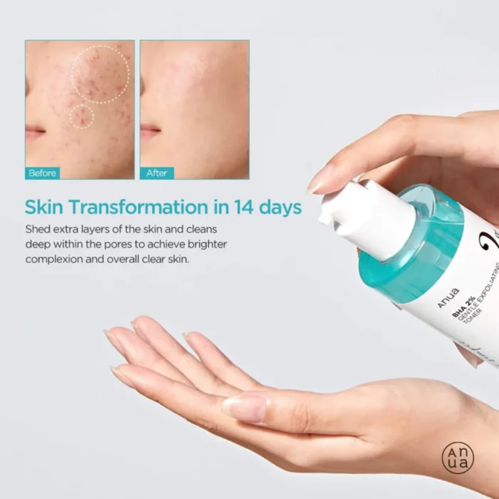 ⁦Anua BHA 2% Gentle Exfoliating Toner, 150 ml⁩ - الصورة ⁦6⁩