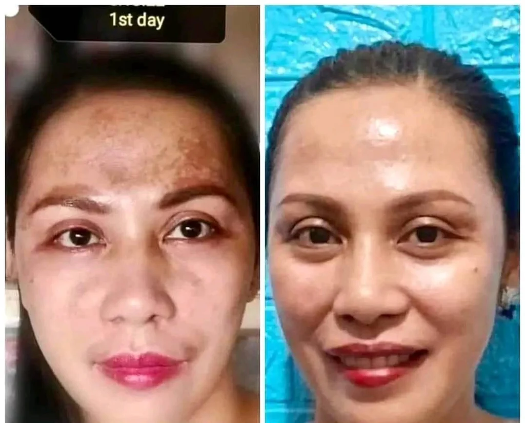 Her choice ph’s PEKAS Remover Cream 50g - الصورة 4