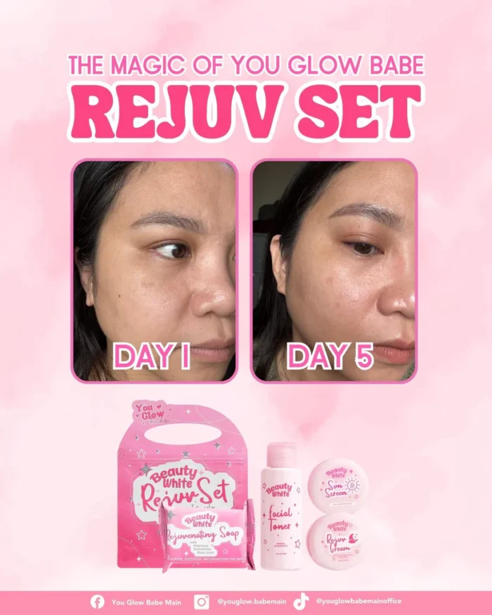 ⁦You Glow Babe Beauty White Rejuv Set⁩ - الصورة ⁦10⁩