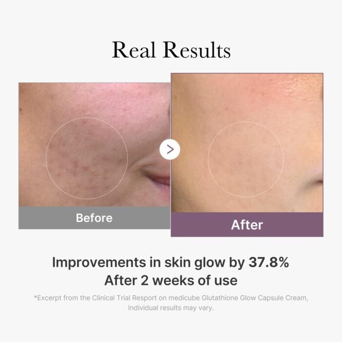 ⁦MEDICUBE AGE-R Glutathione Glow Capsule Cream, 50ml⁩ - الصورة ⁦9⁩