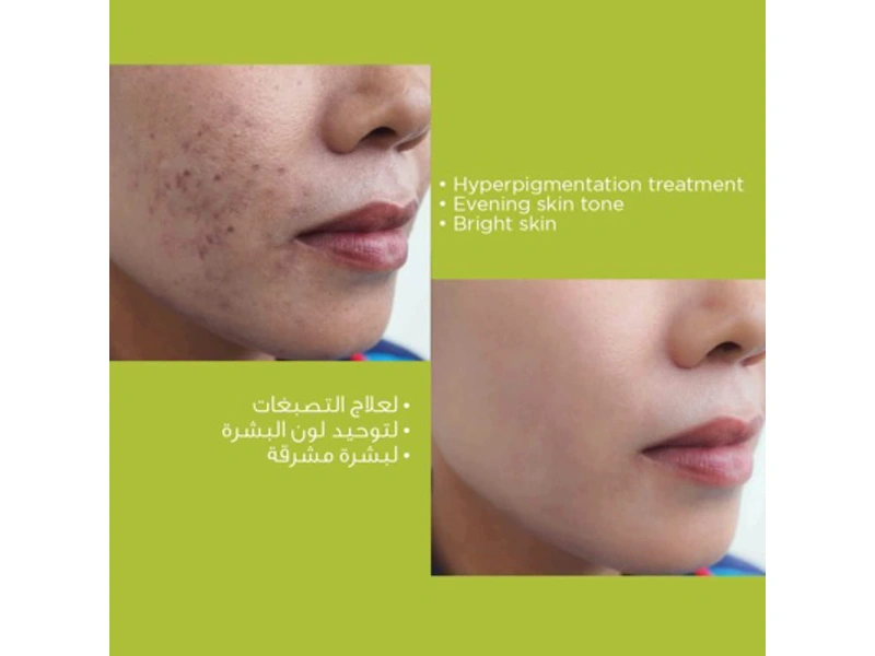 Avalon Pharma Alpha Plus skin brightening Cream, 30 gm - الصورة 9